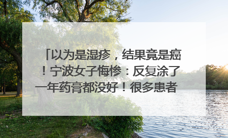 以为是湿疹，结果竟是癌！宁波女子悔惨：反复涂了一年药膏都没好！很多患者首诊都去了皮肤科